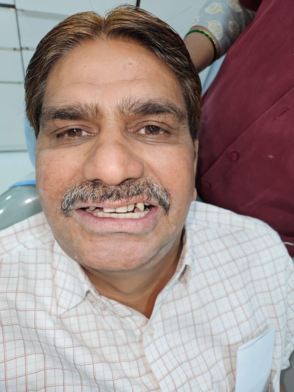 Patient smile before dental treatment